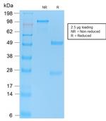 p53 Tumor Suppressor Protein Antibody in SDS-PAGE (SDS-PAGE)