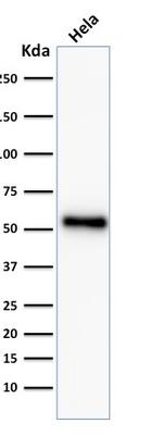 p53 Tumor Suppressor Protein Antibody in Western Blot (WB)