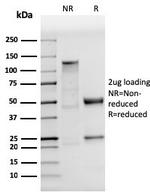 p53 (Tumor Suppressor Protein) Antibody in SDS-PAGE (SDS-PAGE)