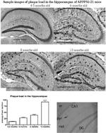 beta Amyloid Antibody in Immunohistochemistry (IHC)