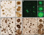 beta Amyloid Antibody in Immunohistochemistry (Frozen) (IHC (F))