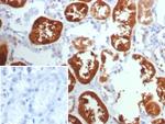 TPH1/Tryptophan Hydroxylase 1 Antibody in Immunohistochemistry (Paraffin) (IHC (P))