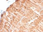 Tropomyosin, alpha-1 chain (striated muscle) Antibody in Immunohistochemistry (Paraffin) (IHC (P))