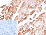 Tropomyosin, alpha-1 chain (striated muscle) Antibody in Immunohistochemistry (Paraffin) (IHC (P))