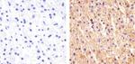 Pan-cadherin Antibody in Immunohistochemistry (Paraffin) (IHC (P))