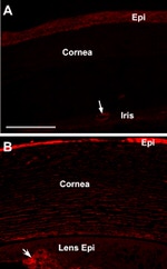 CDH11 Antibody in Immunohistochemistry (Paraffin) (IHC (P))