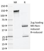 Tryptase Antibody in SDS-PAGE (SDS-PAGE)