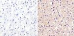 Claudin 1 Antibody in Immunohistochemistry (Paraffin) (IHC (P))