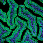 Claudin 1 Antibody in Immunohistochemistry (IHC)