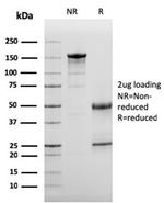 Complement 3d (C3d) (Acute Humoral Rejection Marker) Antibody in Immunoelectrophoresis (IE)