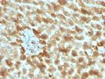 Complement 3d (C3d) (Acute Humoral Rejection Marker) Antibody in Immunohistochemistry (Paraffin) (IHC (P))