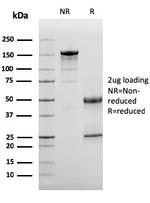 Complement 3d (C3d) Antibody in SDS-PAGE (SDS-PAGE)