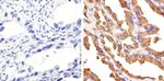 c-Met Antibody in Immunohistochemistry (Paraffin) (IHC (P))