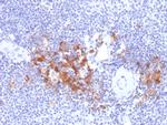 TRAF1 (TNFR-Associated Factor 1) Antibody in Immunohistochemistry (Paraffin) (IHC (P))