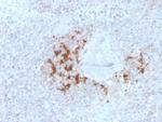 TRAF1 (TNFR-Associated Factor 1) (Lymphomatoid Papulosis Marker) Antibody in Immunohistochemistry (Paraffin) (IHC (P))