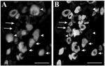 NMDAR2B Antibody in Immunocytochemistry (ICC/IF)