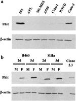 FHIT Antibody in Western Blot (WB)