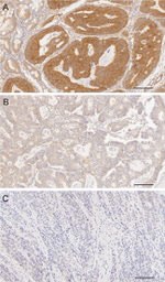 FHIT Antibody in Immunohistochemistry (IHC)