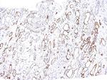 Complement 4d (C4d) Antibody in Immunohistochemistry (Paraffin) (IHC (P))