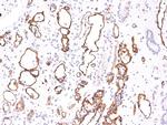 Complement 4d (C4d) Antibody in Immunohistochemistry (Paraffin) (IHC (P))