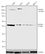 VEGF Receptor 1 Antibody in Western Blot (WB)