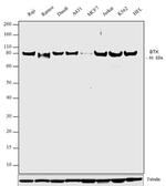 Btk Antibody in Western Blot (WB)