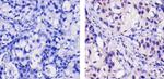 PRMT1 Antibody in Immunohistochemistry (Paraffin) (IHC (P))