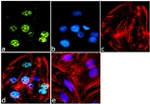 RNF20 Antibody in Immunocytochemistry (ICC/IF)