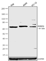 FOXN1 Antibody in Western Blot (WB)