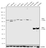 EOMES Antibody in Western Blot (WB)