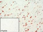 mGluR1 Antibody in Immunohistochemistry (IHC)