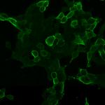 mGluR2 Antibody in Immunocytochemistry (ICC/IF)