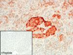 GPR68 Antibody in Immunohistochemistry (IHC)