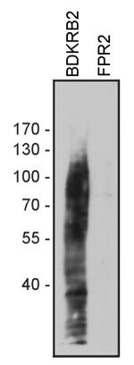 BDKRB2 Antibody in Western Blot (WB)