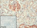 GPR56 Antibody in Immunohistochemistry (IHC)