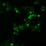 mGluR4 Antibody in Immunocytochemistry (ICC/IF)