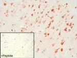 mGluR4 Antibody in Immunohistochemistry (IHC)