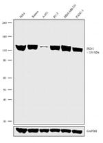 PKN1 Antibody in Western Blot (WB)