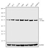 TLK1 Antibody in Western Blot (WB)