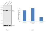 TLK1 Antibody in Western Blot (WB)