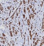 TRPS1 (Transcriptional repressor GATA binding 1) Antibody in Immunohistochemistry (Paraffin) (IHC (P))