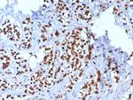 TRPS1 (Transcriptional repressor GATA binding 1) Antibody in Immunohistochemistry (Paraffin) (IHC (P))