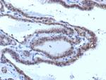 TSH-Receptor, A-Chain (Thyroid Marker) Antibody in Immunohistochemistry (Paraffin) (IHC (P))