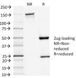 TSH-Receptor, A-Chain (Thyroid Marker) Antibody in SDS-PAGE (SDS-PAGE)