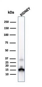 Transthyretin (Prealbumin) Antibody in Western Blot (WB)