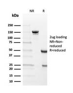 Transthyretin (Prealbumin) Antibody in SDS-PAGE (SDS-PAGE)