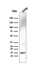 Transthyretin (Prealbumin) Antibody in Western Blot (WB)