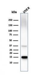 Transthyretin (Prealbumin) Antibody in Western Blot (WB)