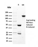 Transthyretin (Prealbumin) Antibody in SDS-PAGE (SDS-PAGE)