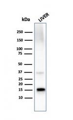 Transthyretin (Prealbumin) Antibody in Western Blot (WB)